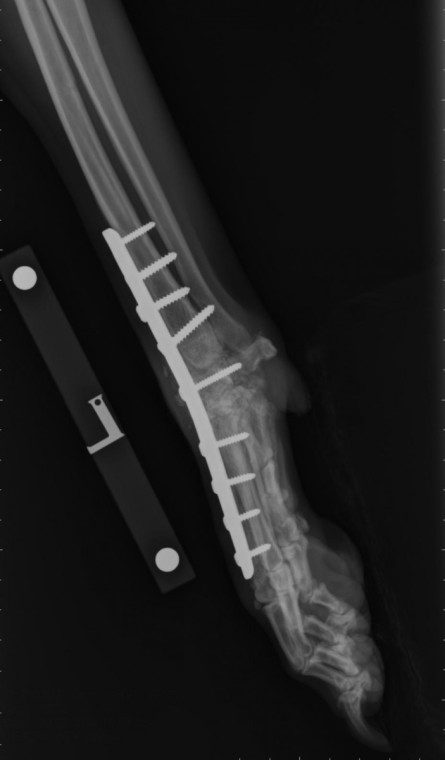 Pancarpal arthrodesis for carpal hyperextension