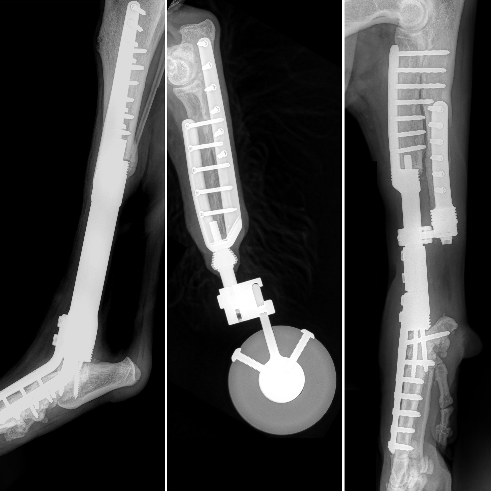 Limb sparing surgery - Fitzpatrick Referrals