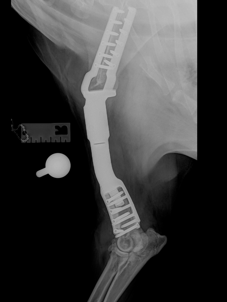 Radiograph scapulo-humeral endoprosthesis
