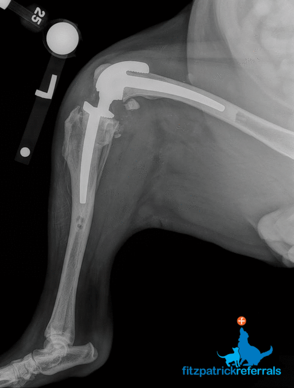 Radiograph custom hinged total knee replacement