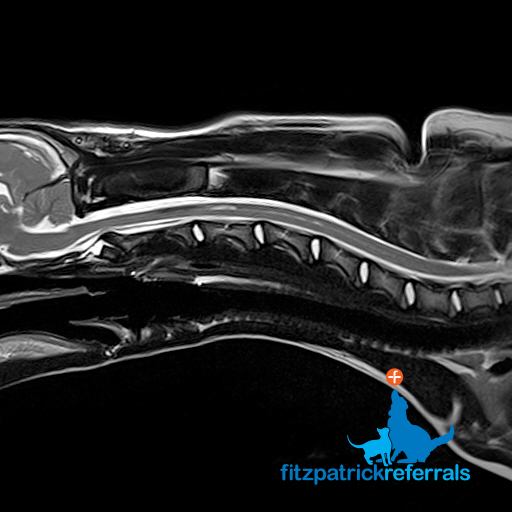 MRI scan of a 6-month-old puppy's spine 5 weeks post-surgery for hydrocephalus at Fitzpatrick Referrals showing the syringomyelia (fluid-filled cavities) have mostly resolved
