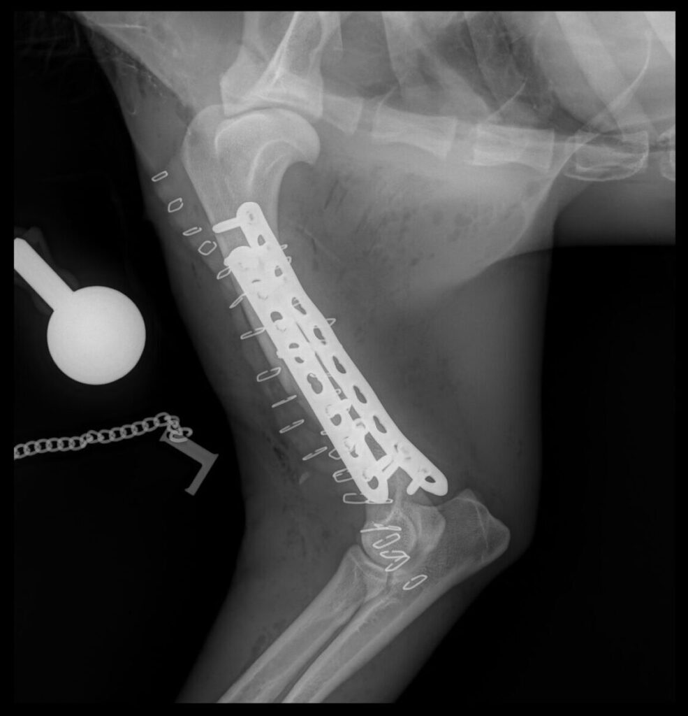 After x-rays of a fractured left humerus