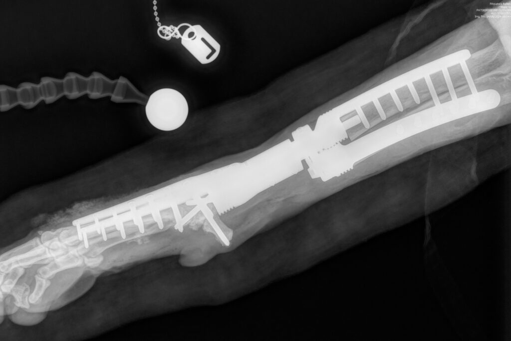 Postop radiograph of a radial endoprosthesis in a Weimaraner dog