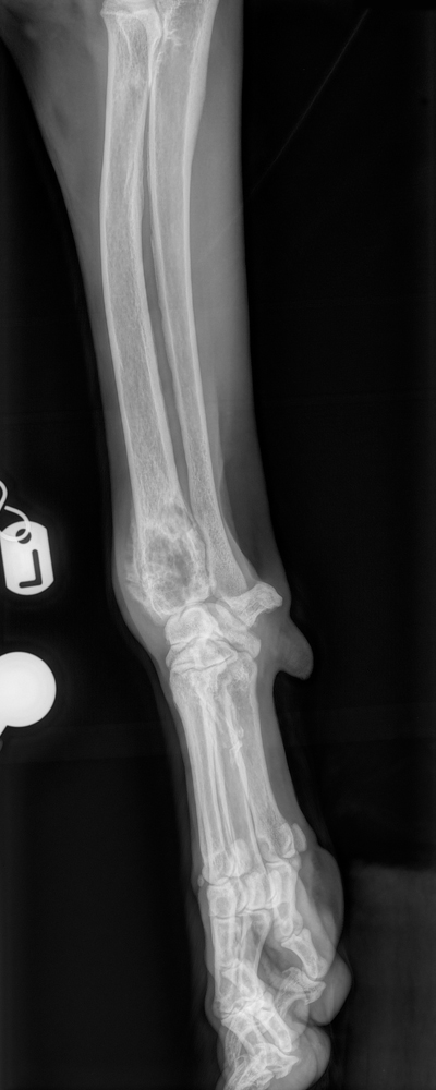 Radiograph of an osteolytic distal radial tumour (osteosarcoma) in a Weimaraner dog